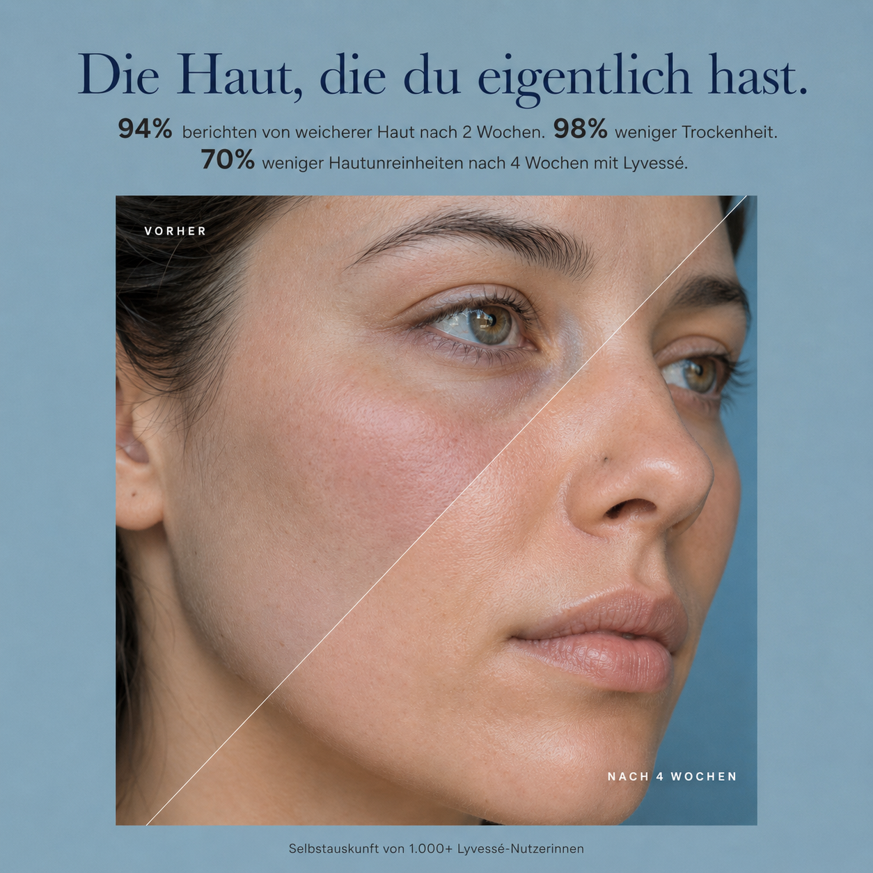 Lyvessé Filter-Duschkopf — Gefiltertes Duschwasser.